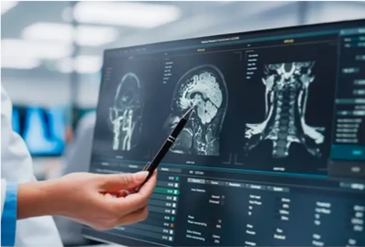 images of brain scan